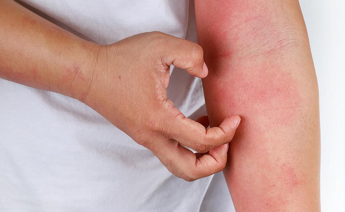 kemungkinan komplikasi dari penggunaan soda