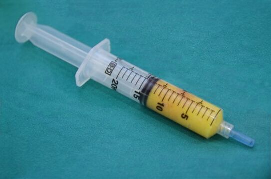 Jarum suntik dengan jaringan adiposa untuk lipofilling
