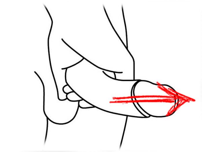 meregangkan penis untuk pembesaran